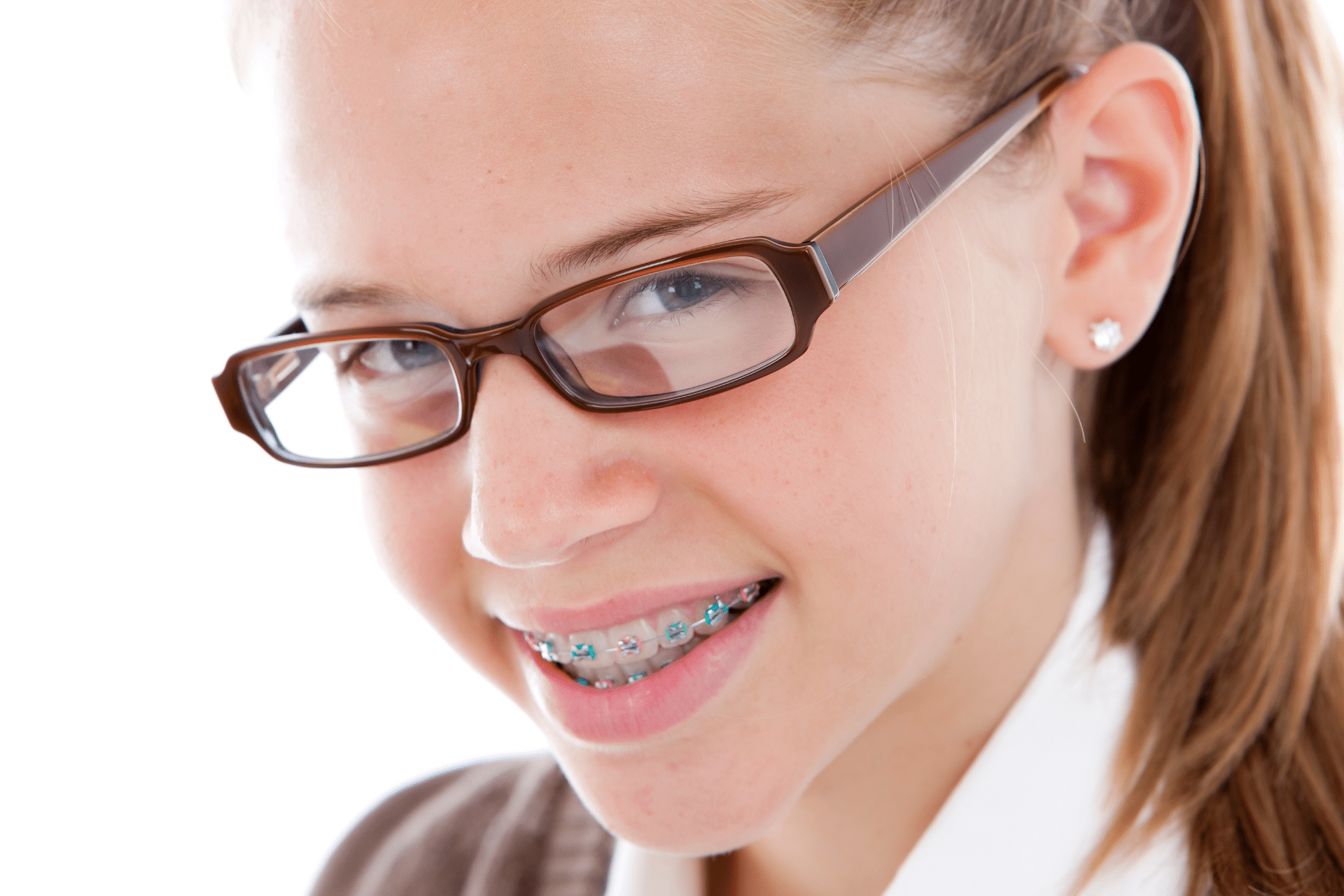 Close-up of girl with glasses and braces | Nudera Orthodontics