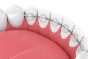 Nudera Orthodontics Group
In Rockford & Winniebago, IL