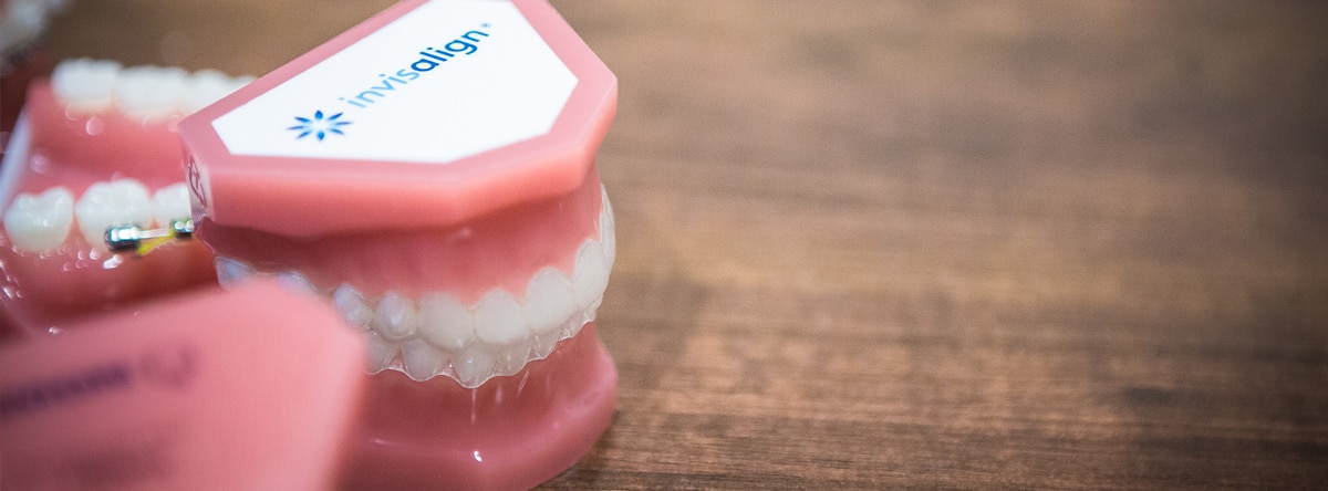 Anatomical model of teeth and gums | Nudera Orthodontics